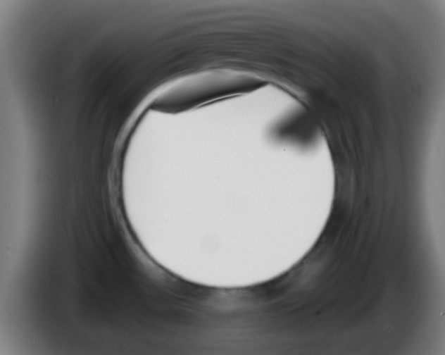 X0000086251531200704261926