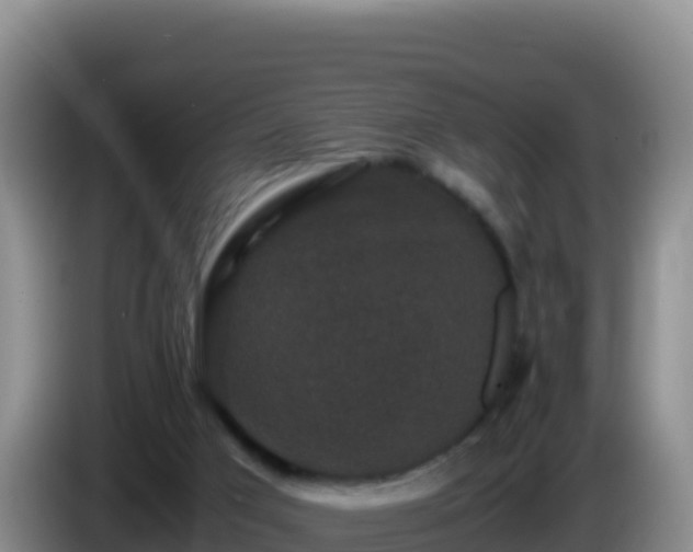 X0000086260017200704051312