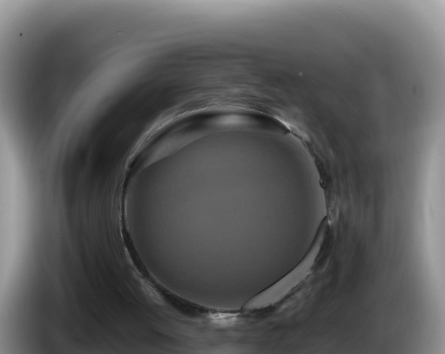 X0000086260052200704051311