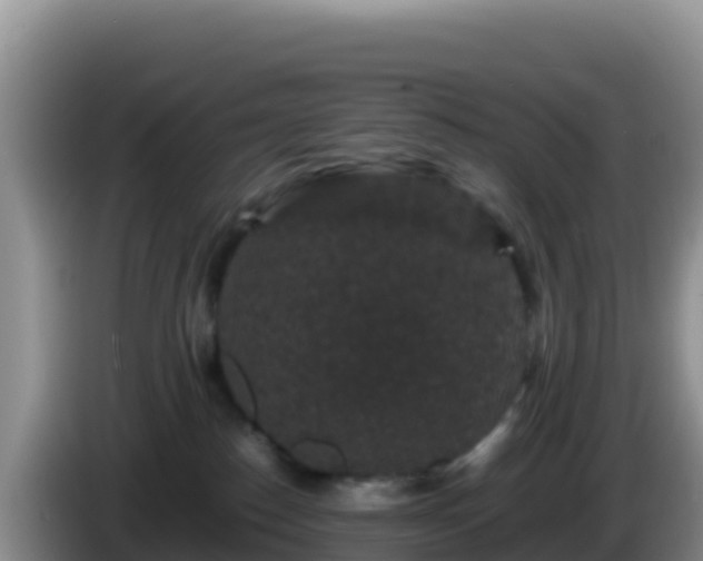 X0000086260186200704051310