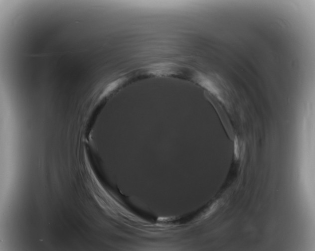 X0000086260205200704051309