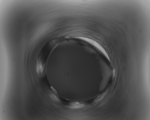 X0000086260239200704051309
