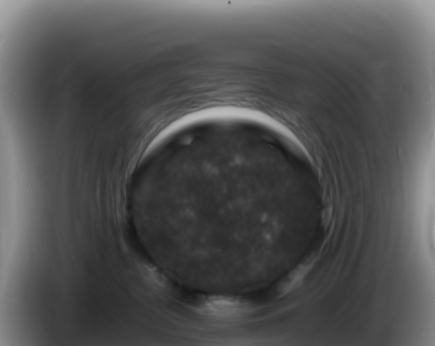 X0000086260380200704051308