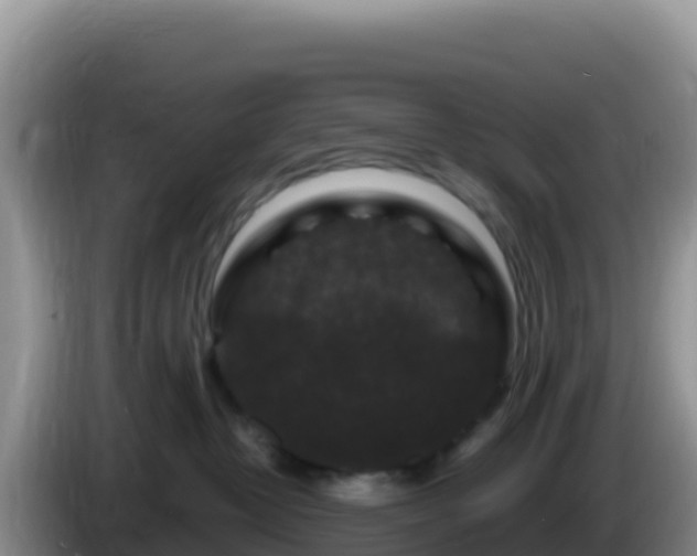 X0000086260382200704051308