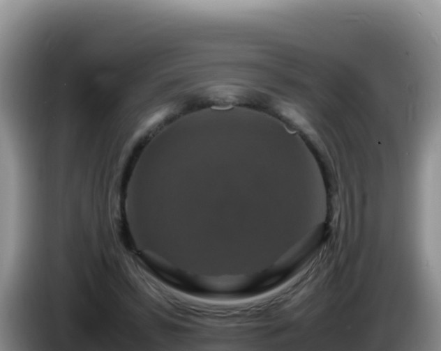 X0000086260399200704051307
