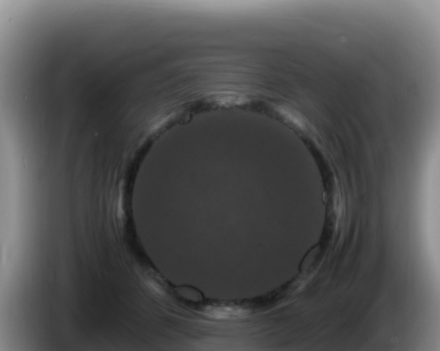 X0000086260512200704051305