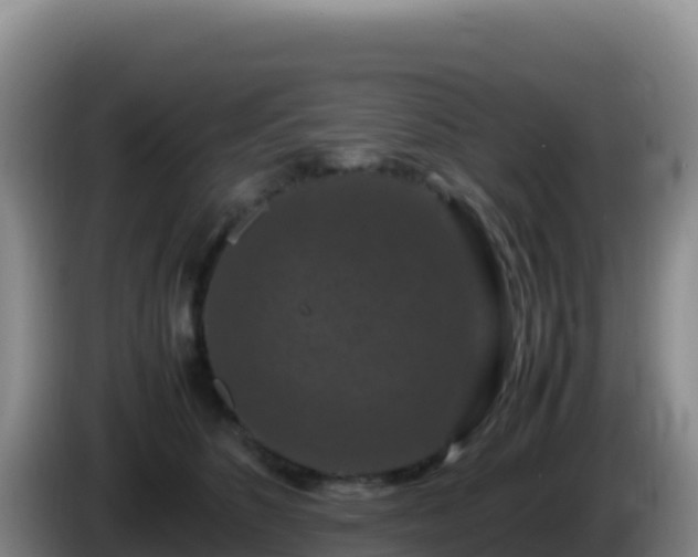 X0000086260516200704051305
