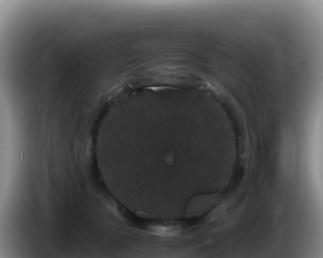 X0000086260563200704051305