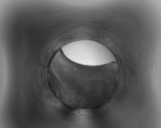X0000086260672200704051304