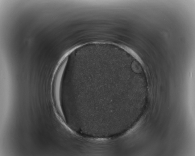 X0000086260839200704051301