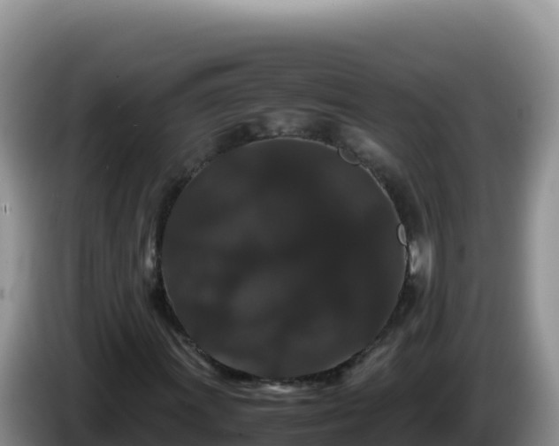 X0000086261011200704051258