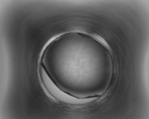 X0000086261144200704051257