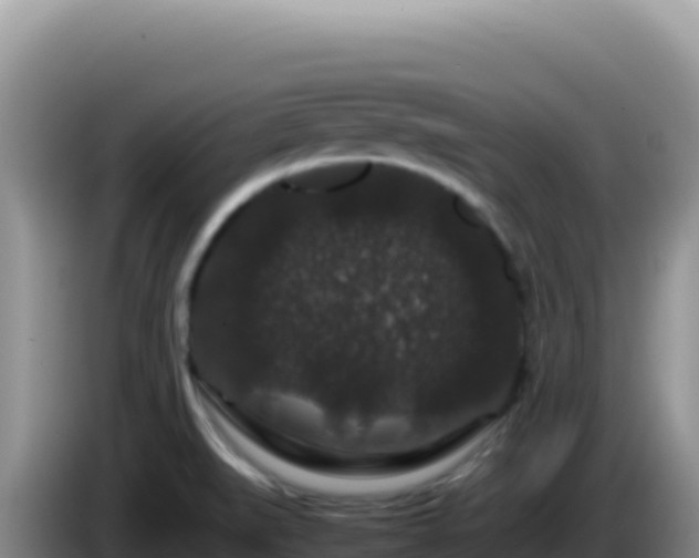X0000086261519200704051251