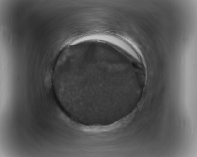 X0000086260009200704122018