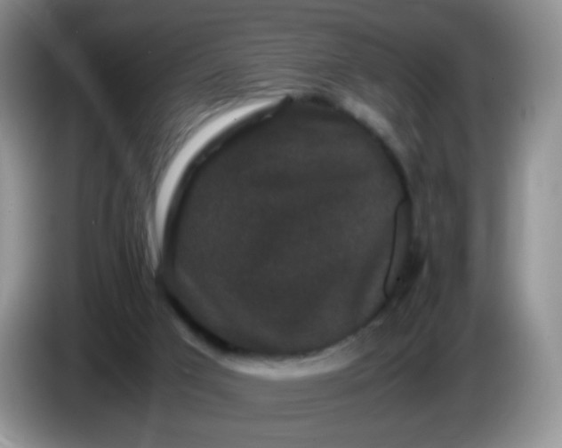 X0000086260017200704122018