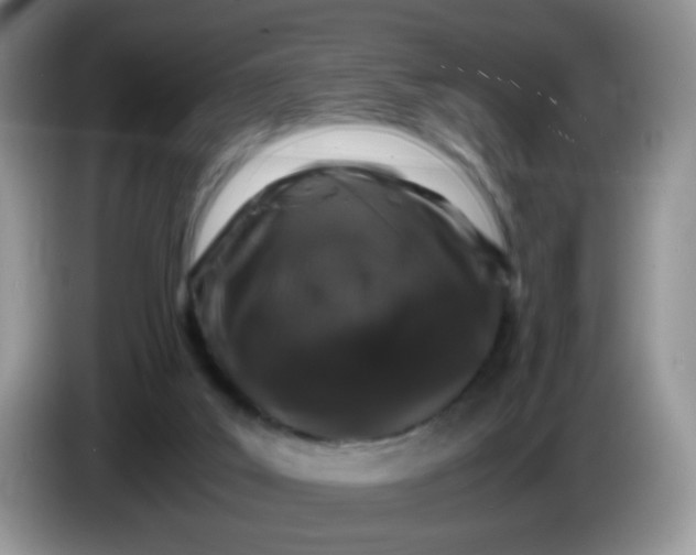 X0000086260019200704122018