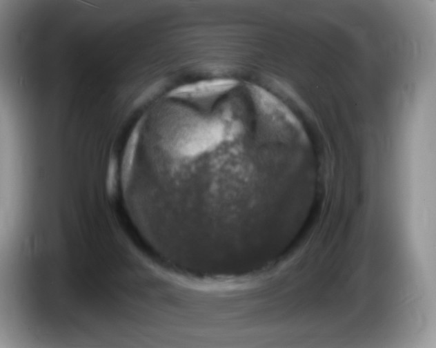 X0000086260024200704122018