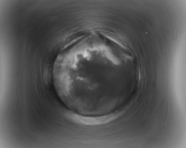 X0000086260030200704122018
