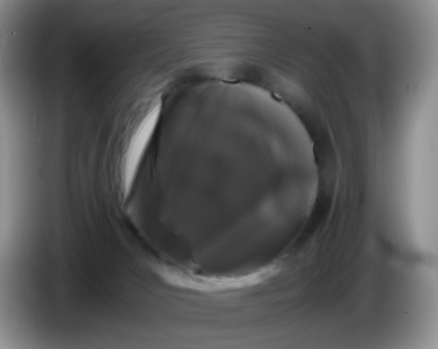 X0000086260031200704122018