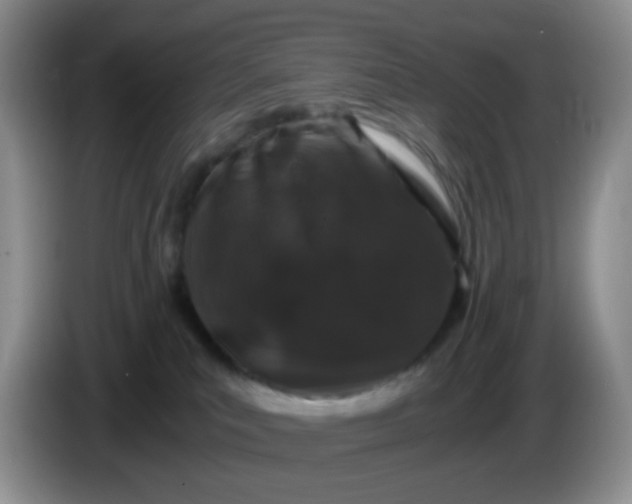 X0000086260039200704122018
