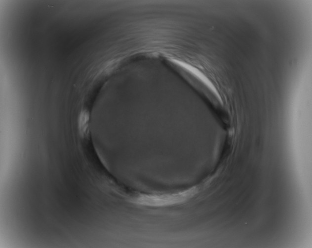 X0000086260041200704122018