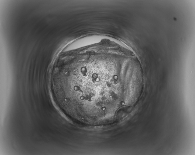 X0000086260049200704122017