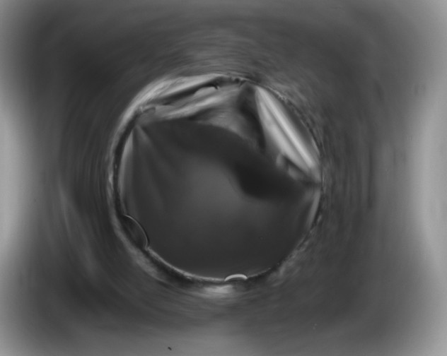 X0000086260054200704122017