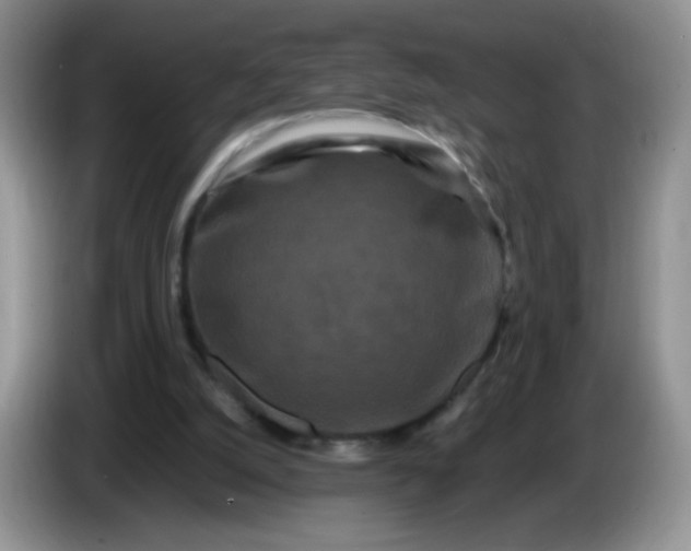 X0000086260056200704122017