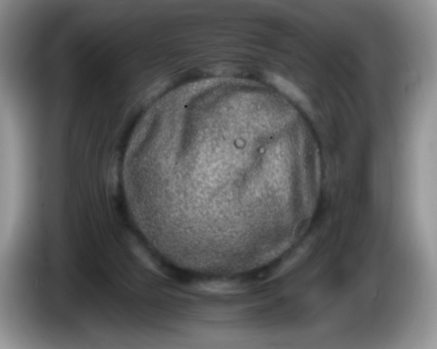 X0000086260065200704122017