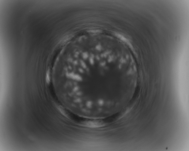 X0000086260069200704122017