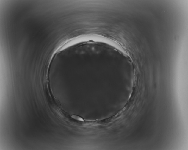 X0000086260099200704122017