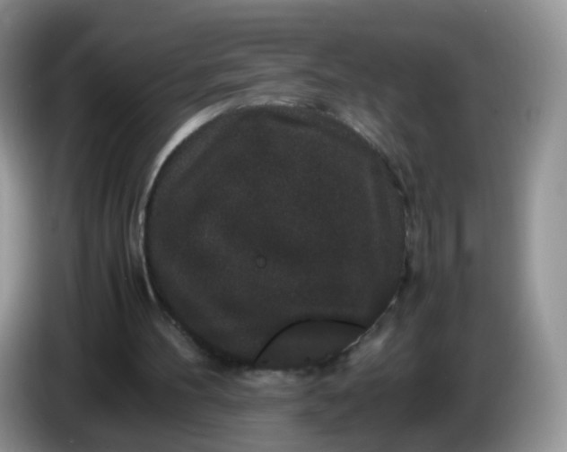 X0000086260100200704122017