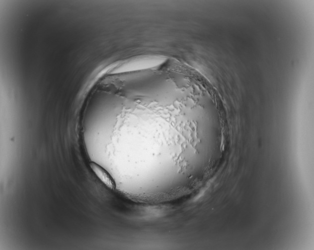 X0000086260103200704122017