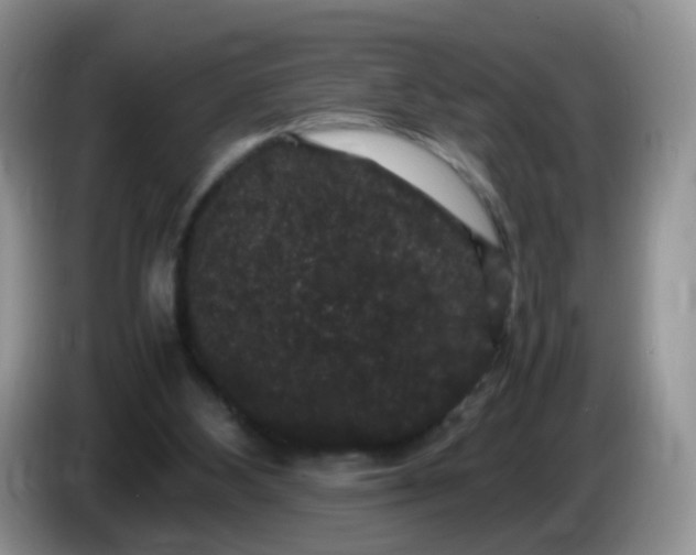 X0000086260108200704122017
