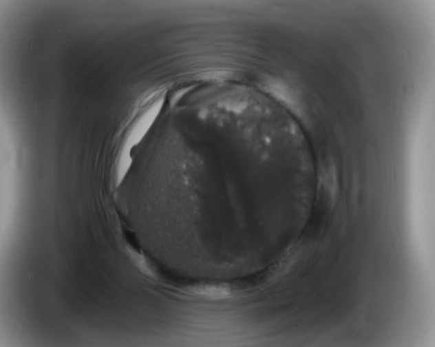 X0000086260110200704122017