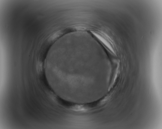 X0000086260117200704122017