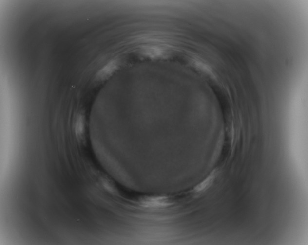 X0000086260132200704122017