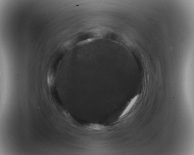 X0000086260137200704122017