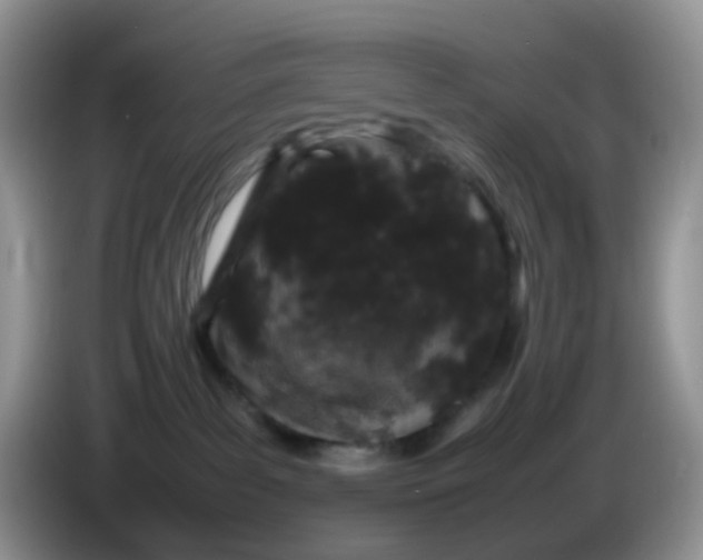 X0000086260139200704122017