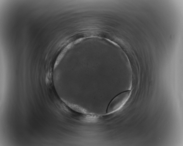 X0000086260144200704122017