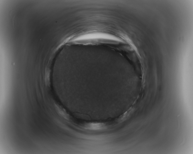 X0000086260154200704122016
