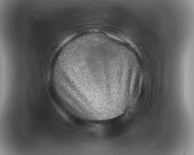 X0000086260159200704122016