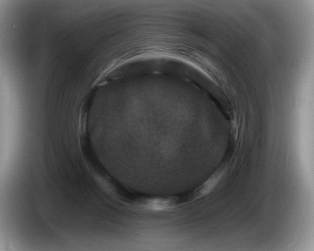 X0000086260168200704122016