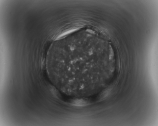 X0000086260177200704122016