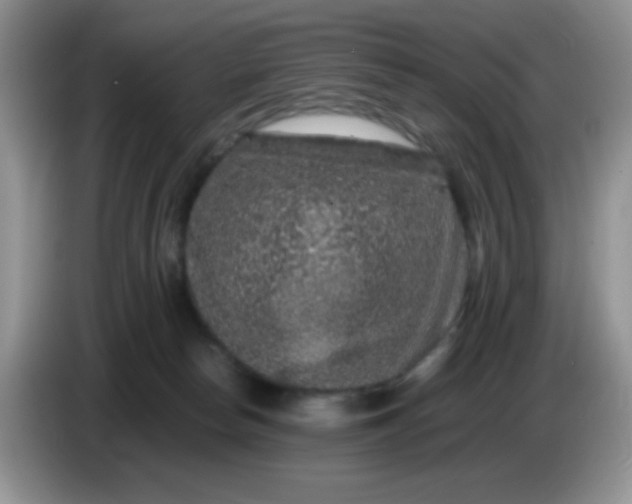 X0000086260178200704122017