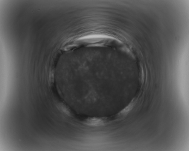 X0000086260180200704122017