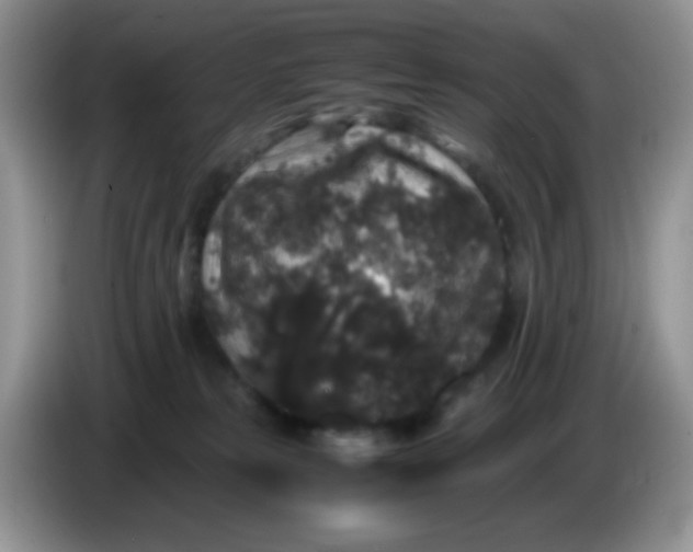 X0000086260181200704122017