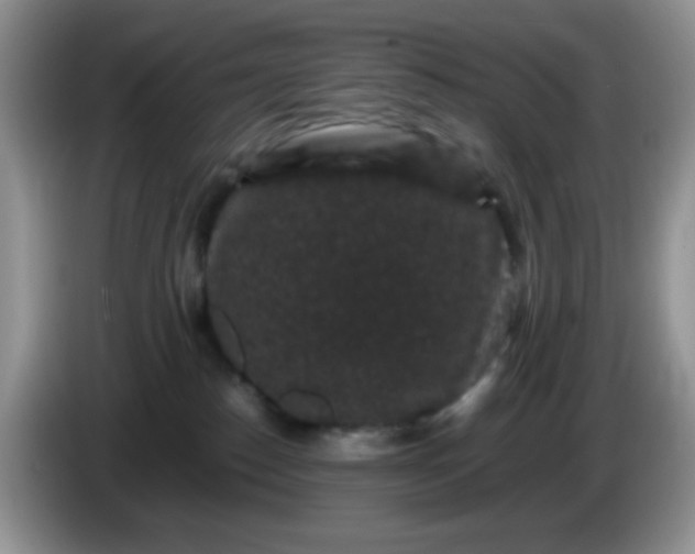 X0000086260186200704122017