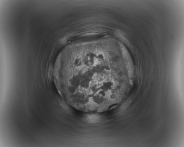 X0000086260189200704122017