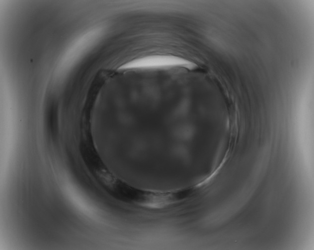 X0000086260191200704122017